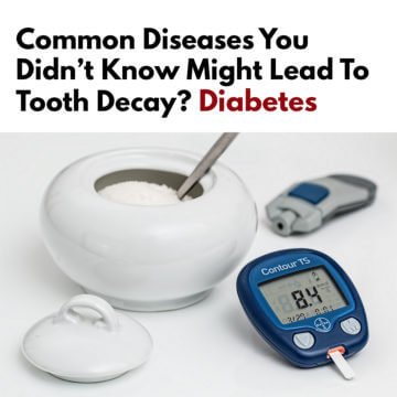Diabetes can led to Tooth Decay